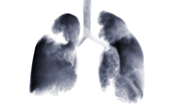 lung-2